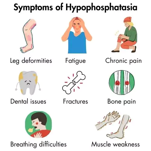 Hypophosphatasia Symptoms