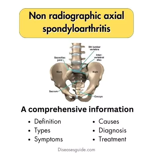 Non radiographic axial spondyloarthritis
