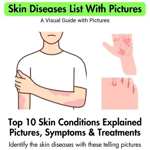 Skin Diseases List With Pictures