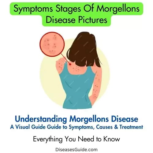 symptoms stages of morgellons disease pictures