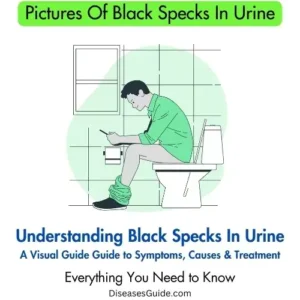 black specks in urine before period