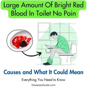 large amount of bright red blood in toilet no pain