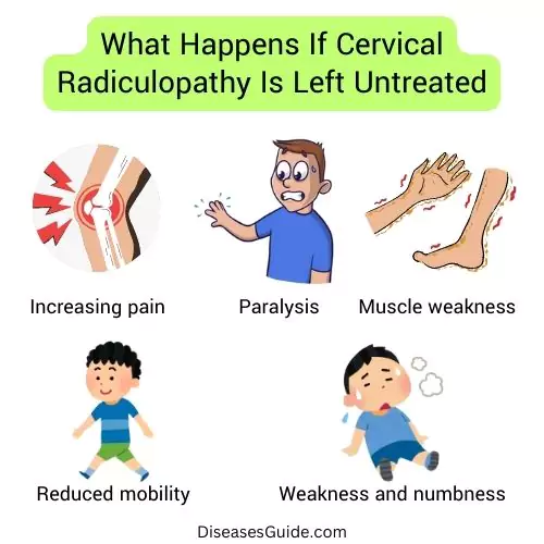 What Happens If Cervical Radiculopathy Is Left Untreated