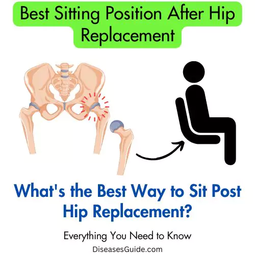 Best Sitting Position After Hip Replacement